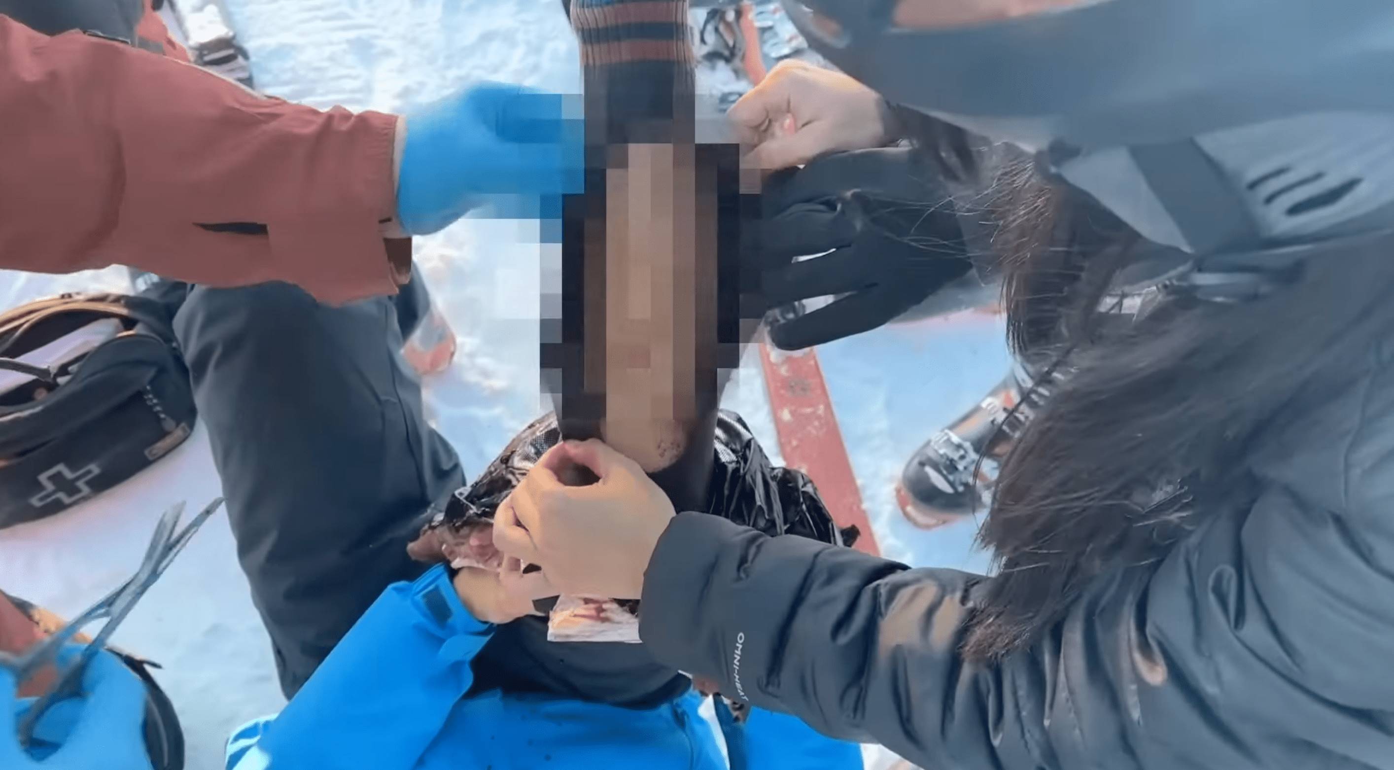 J-Bao賤葆在挪威滑雪時遭逢受傷意外。