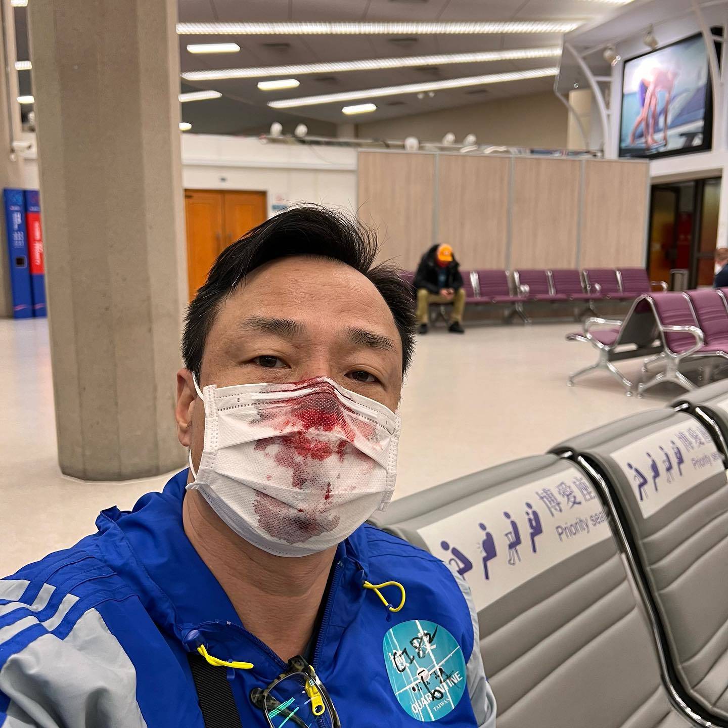 王喜指控機場採檢人員捅傷其右邊鼻孔，導致血流不止